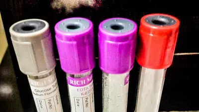 Blood collection tubes with colored caps used for laboratory tests
