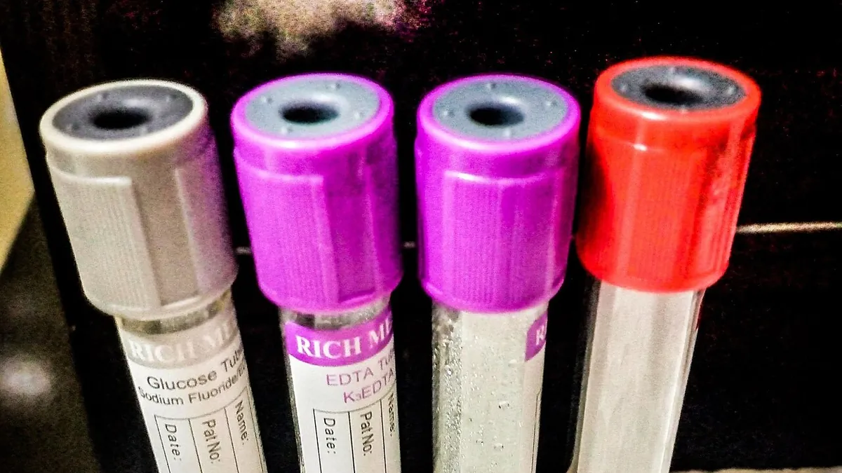 Blood collection tubes with colored caps used for laboratory tests