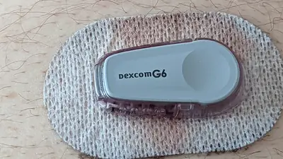 A continuous glucose monitor sensor worn on the skin