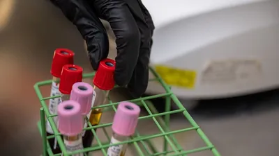 Gloved hand placing blood sample tubes in a rack for lab testing
