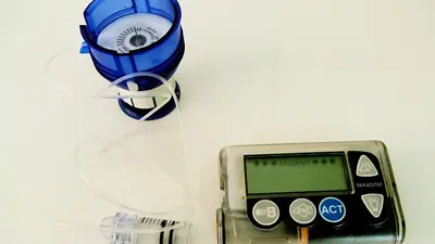 An insulin pump with its infusion set